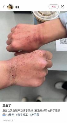 亚力斯特是正规厂家吗？消毒水期货